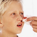 Sådan standser du næseblod